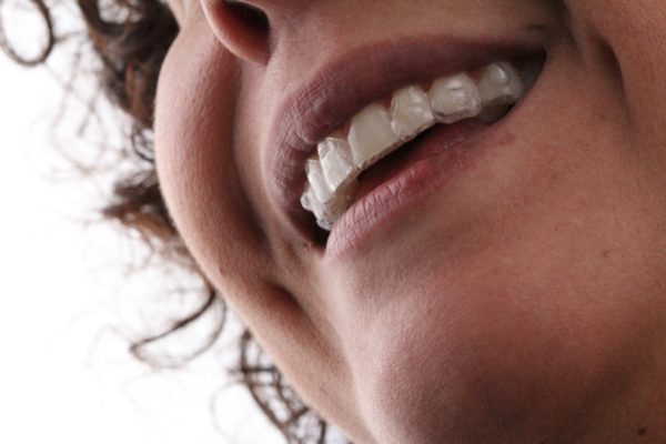 WhatsApp mulher usando Invisalign AR odontologia