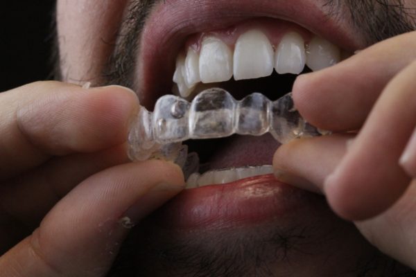 WhatsApp homem sorrindo e colocando Invisalign AR odontologia