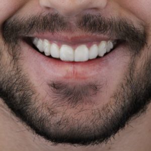 WhatsApp homem sorrindo Invisalign AR odontologia