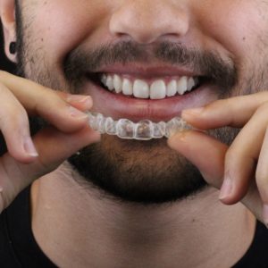 WhatsApp boca de homem sorrindo Invisalign AR odontologia