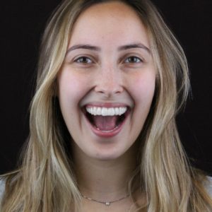 WhatsApp boca sorrindo muito grande Invisalign AR odontologia