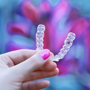 Na hora de colocar o meu invisalign