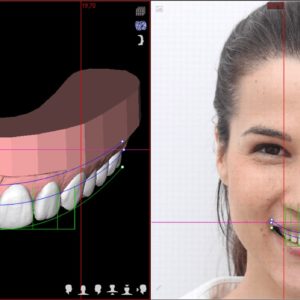 Digital Smile Design