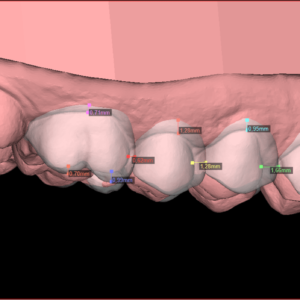 Digital Smile Design