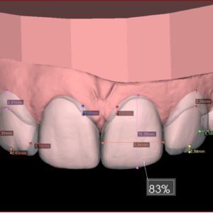 Digital Smile Design