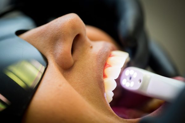 Carlos de Carvalho, uma das maiores autoridades da atual Odontologia Adesiva Rehabilitadora