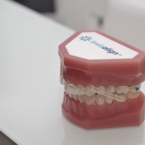 ALYSSON RESENDE DIAMOND EMERALD INVISALIGN DOCTOR