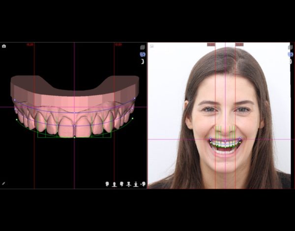DSL - Digital Smile Design