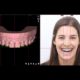 DSL - Digital Smile Design