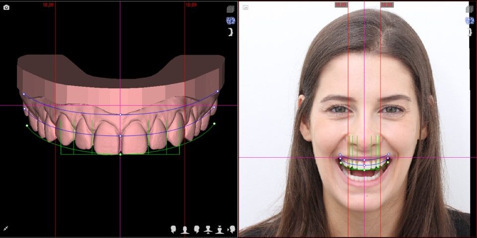 DSL - Digital Smile Design