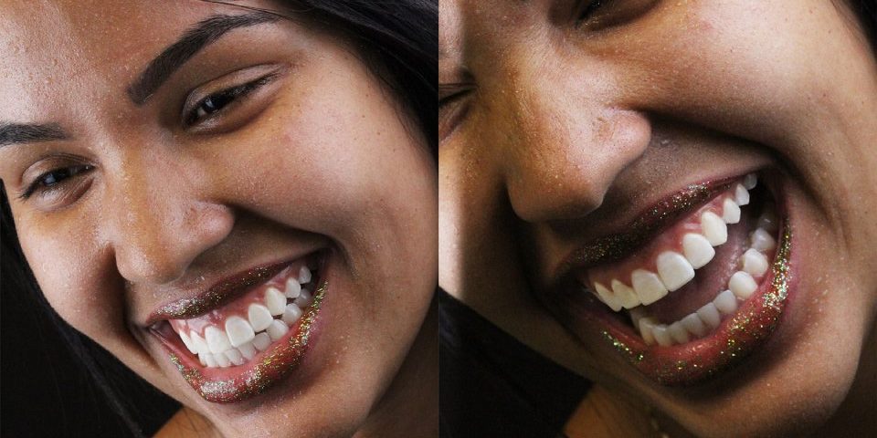 Sorrisos em cada detalhe da boca