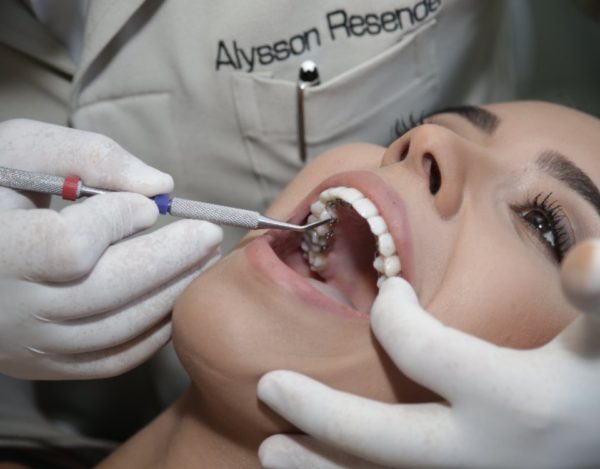 Acredite: podemos esconder o seu aparelho fixo