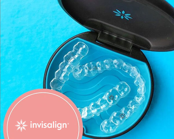 Como será o seu primeiro contato na consulta de Invisalign
